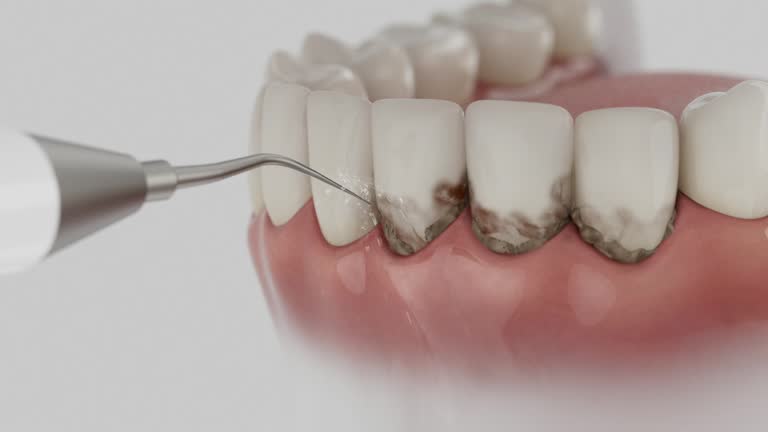 Reliable Teeth Cleaning And Checkup contractor in Issaquena County County, MS by Dentist Open Now